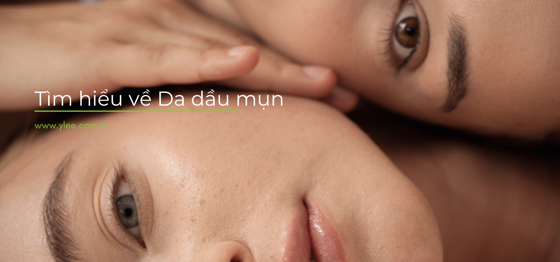 Cùng YLEE tìm hiểu về da dầu mụn