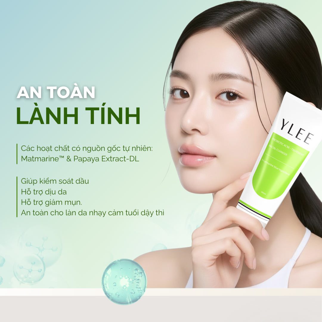 Sữa rửa mặt cho da mụn tuổi dậy thì